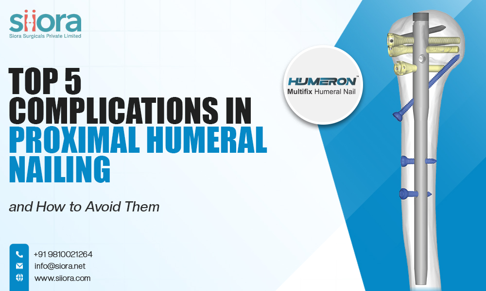 Top 5 Complications in Proximal Humeral Nailing and How to Avoid Them